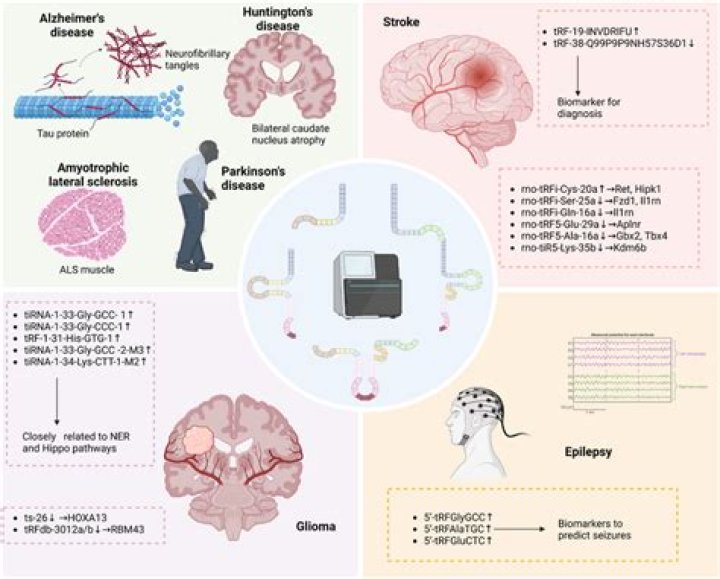 Understanding ATPL Brain Disease: Insights, Impact, and Innovations