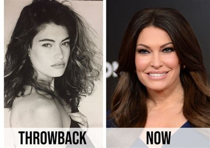 Kimberly Guilfoyle's Transformation: Uncovering the Before and After