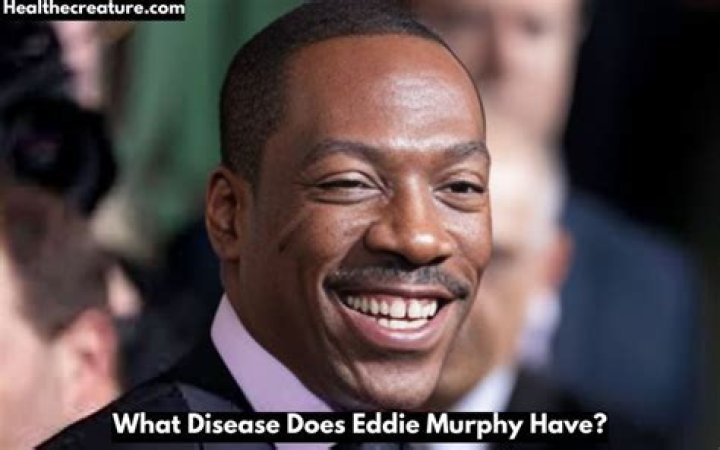 What Disease Does Eddie Murphy Have? Exploring the Health Challenges of the Iconic Comedian